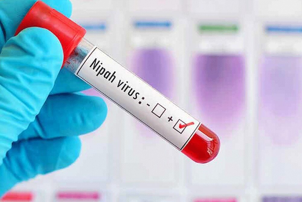 nipah virus